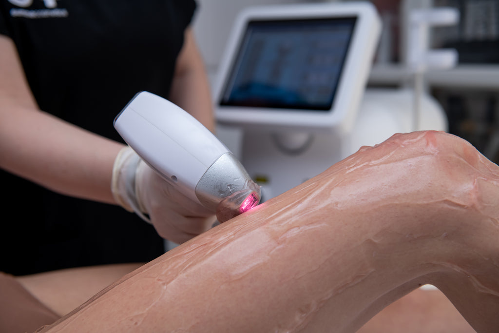 Aparat Epilare Progresiv Definitivă - 3 lungimi de undă